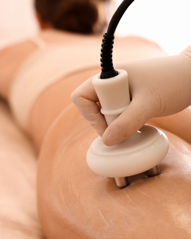 Celulit Uklanjanje Vivaderm Varaždin