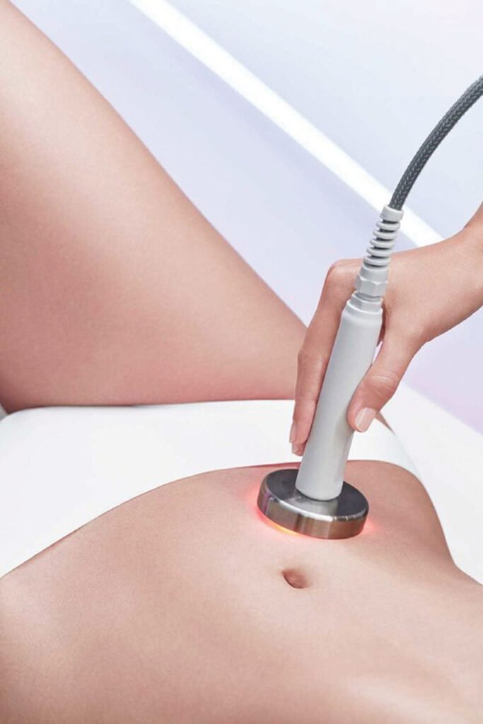 vrhunski anticelulitni tretman